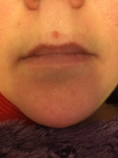 what is this on my face??? (pic attached)