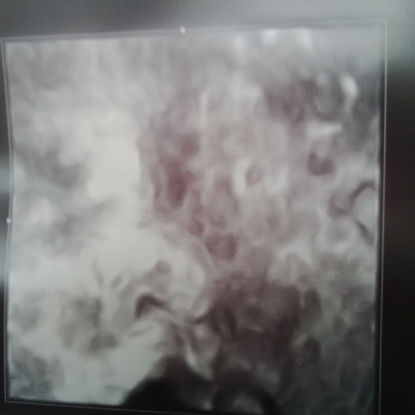 March 2016 Babies #9 - we're on the final countdown!!