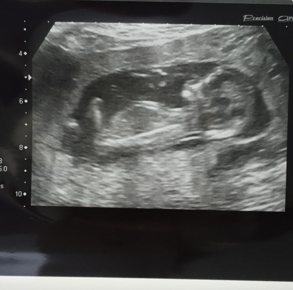 It's the calm before the storm (sort of) that is Fantastic February and the March Madness - we did a lot of shagging last summer! We need more JSers on this, our 44th thread!