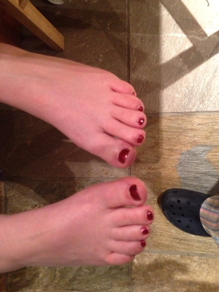 Red marks appearing on body for apparently no reason?