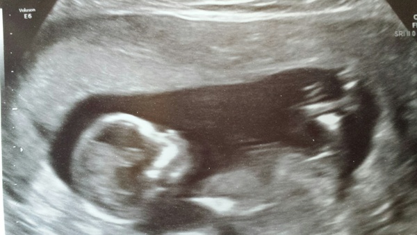 Pregnant at forty and over - thread 2