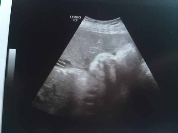 March 2016 Babies #9 - we're on the final countdown!!