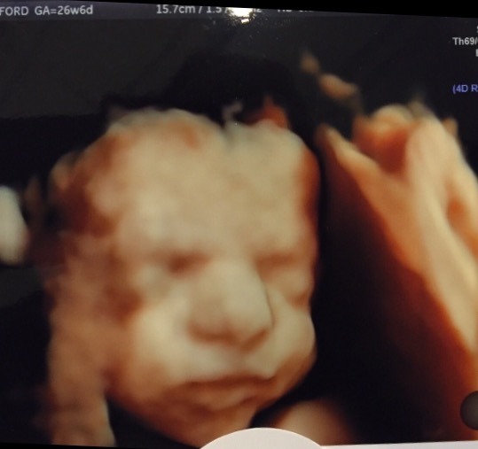 March 2016 Babies!! New Year, New Thread - #8