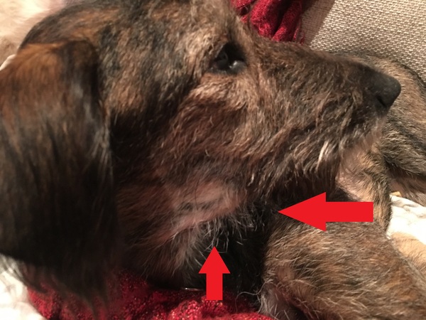 Salivary gland infection/cyst?