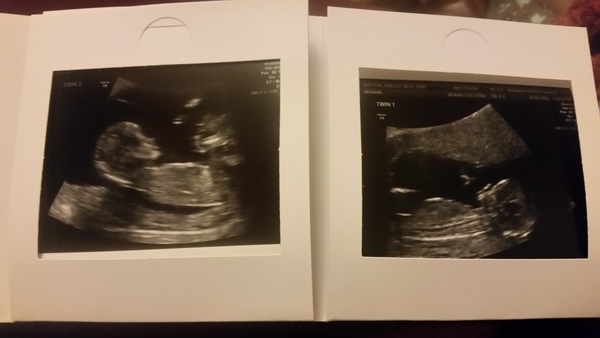 It's the calm before the storm (sort of) that is Fantastic February and the March Madness - we did a lot of shagging last summer! We need more JSers on this, our 44th thread!