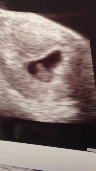 Are these positive???