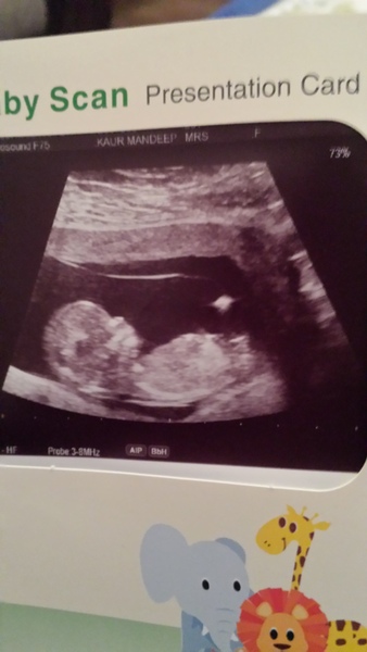Boy or girl at 12 week scan?