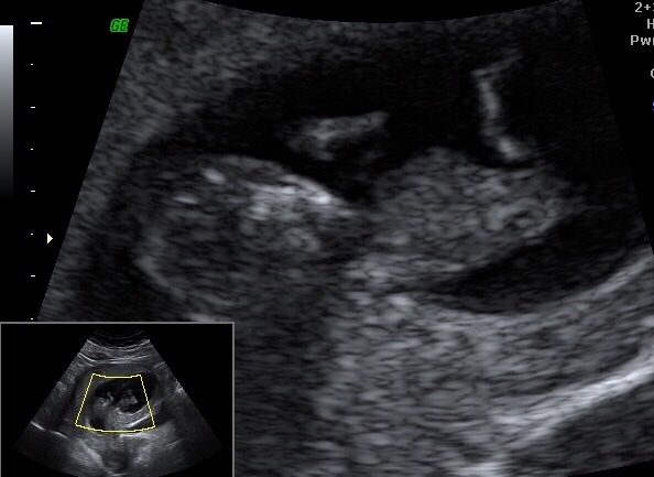 August 2016-with Berries turning into Beans and a whole lotta fun ahead!