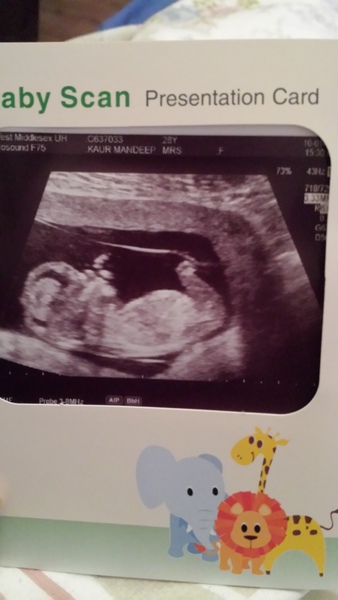 Boy or girl at 12 week scan?