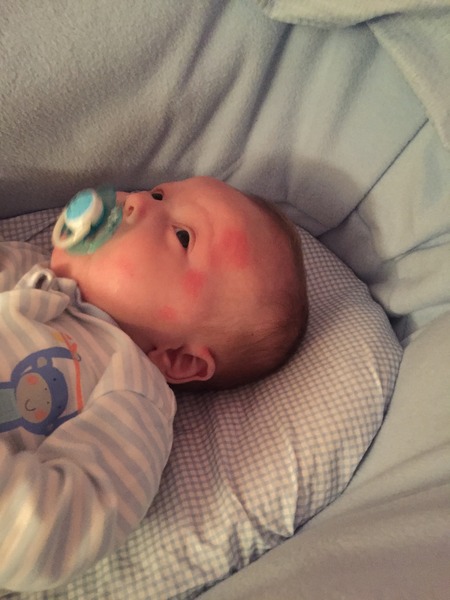 10 week old keeps coming out in hives, I thought it was a pollen allergy. Advice please!