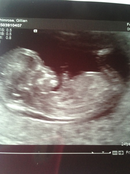Anyone ttc baby #2 continued?