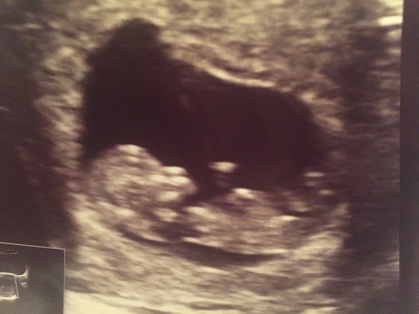 August 2016 (3) - scans fast approaching, teeny tiny bumps appearing, and sickness easing....we hope!