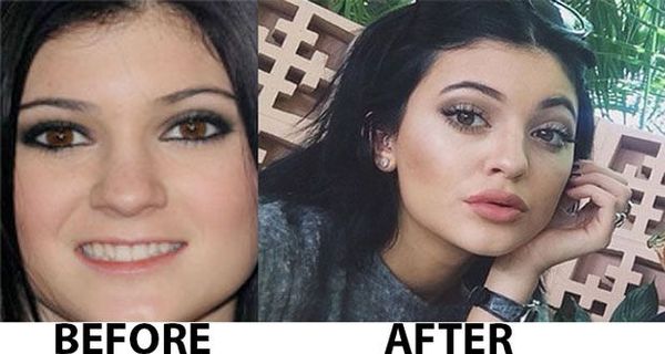 To think Kylie Jenner is the best looking Kardashian/Jenner