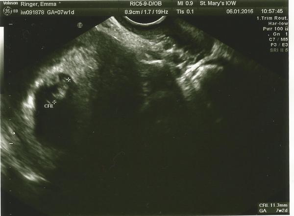 August 2016-with Berries turning into Beans and a whole lotta fun ahead!