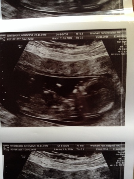 August 2016 (3) - scans fast approaching, teeny tiny bumps appearing, and sickness easing....we hope!