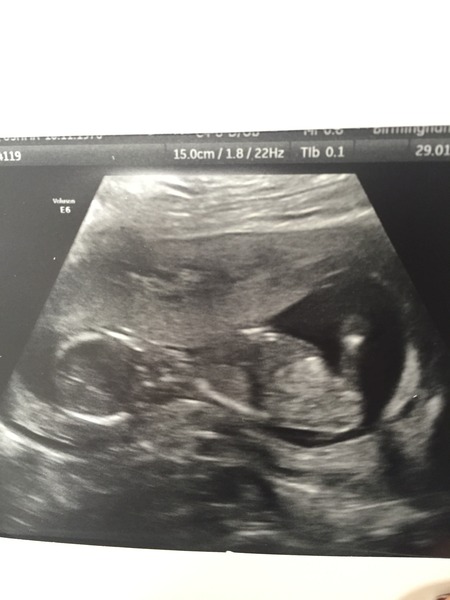 14 weeks and 5 days - desperate to know gender!! Help