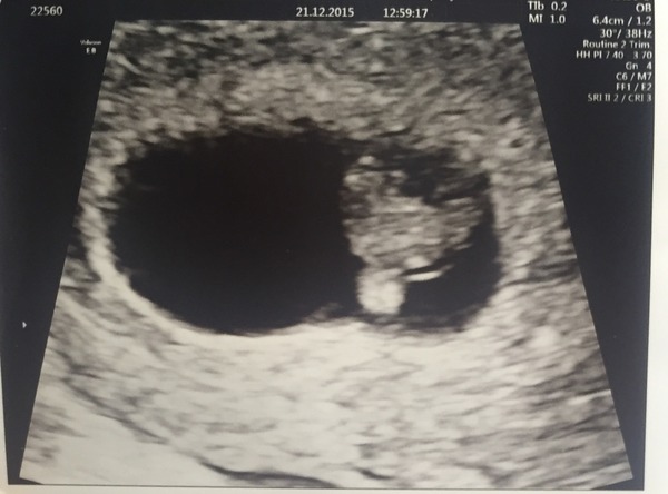 August 2016-with Berries turning into Beans and a whole lotta fun ahead!