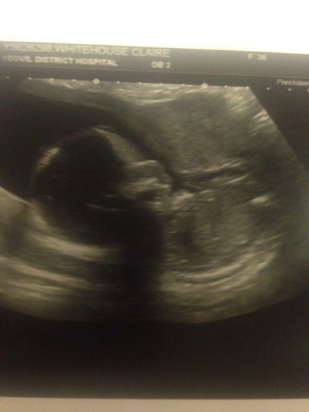 June 2016 #6, Blue? Pink? Yellow? Where did the first 20 weeks go?