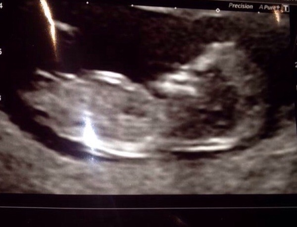boy or girl?
