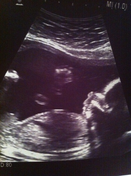 June 2016 #6, Blue? Pink? Yellow? Where did the first 20 weeks go?