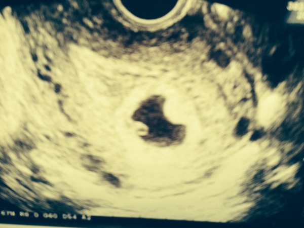 August 2016-with Berries turning into Beans and a whole lotta fun ahead!