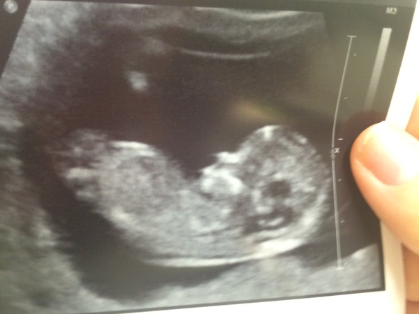Am I having a boy or a girl?!