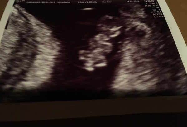 thread #2 - TTC#1 Grads, sick bags at the ready!