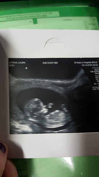 Gender guess....?