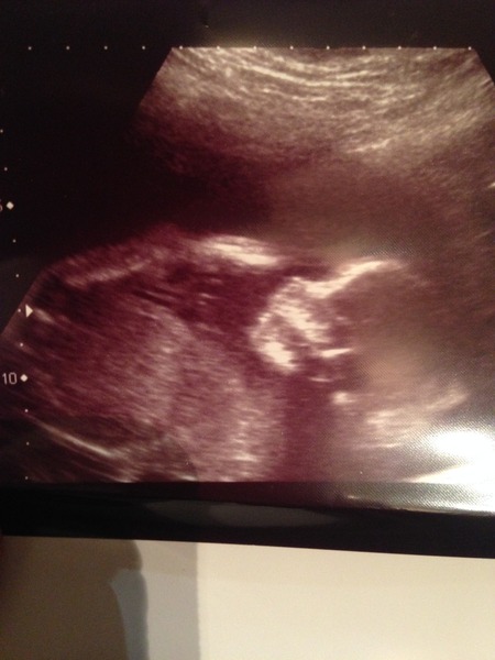 Gender guesses?
