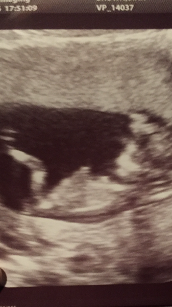 Girly or boy? scan pictures attached :)
