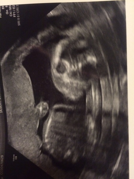 Boy or Girl...help!