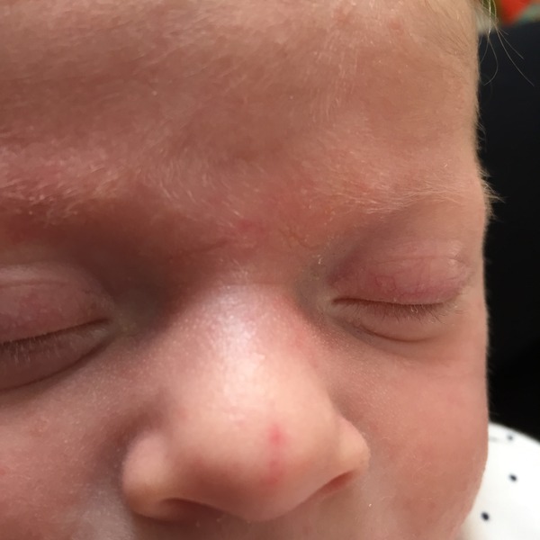 What's this on my baby's nose?