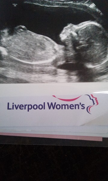 June 2016 #6, Blue? Pink? Yellow? Where did the first 20 weeks go?