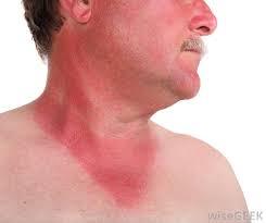 DH has been cleansing his face ... with anti-bacterial bathroom wipes.