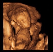 June 2016 thread #5 Starting the great gender speculation. ..