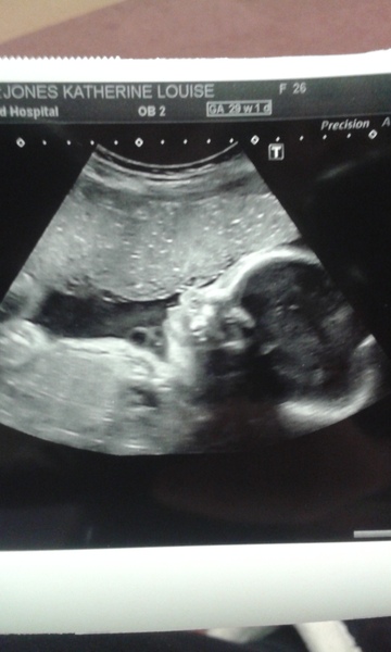 March 2016 Babies!! Thread #7 The one where we all say.... "Stay put Flump!!"