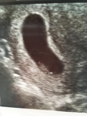 Anyone ttc baby #2 continued?
