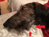 Salivary gland infection/cyst?