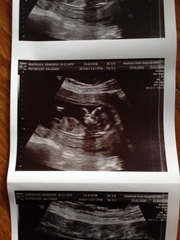 August 2016 (3) - scans fast approaching, teeny tiny bumps appearing, and sickness easing....we hope!