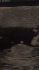 Girly or boy? scan pictures attached :)