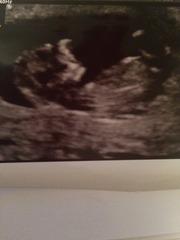 August 2016 (3) - scans fast approaching, teeny tiny bumps appearing, and sickness easing....we hope!