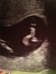 August 2016 (3) - scans fast approaching, teeny tiny bumps appearing, and sickness easing....we hope!