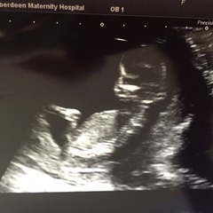 August 2016 (3) - scans fast approaching, teeny tiny bumps appearing, and sickness easing....we hope!