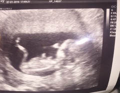 Baby girl or baby boy? 12 weeks 5 days
