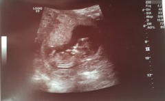 August 2016 (3) - scans fast approaching, teeny tiny bumps appearing, and sickness easing....we hope!