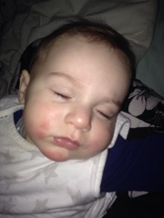 what is this on my baby's face?