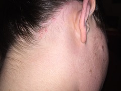 Does anyone know what these spots are on my scalp?
