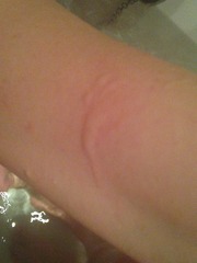 Red marks appearing on body for apparently no reason?