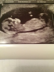 August 2016 (3) - scans fast approaching, teeny tiny bumps appearing, and sickness easing....we hope!