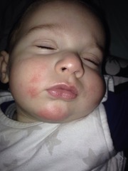 what is this on my baby's face?